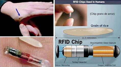 rfid chip patent|who makes the rfid chip.